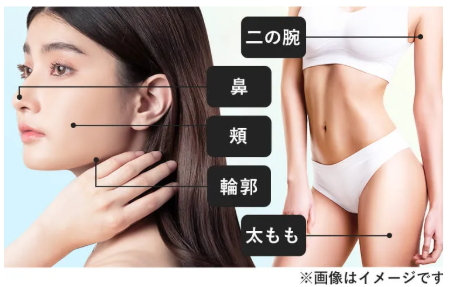 気になる部位の脂肪吸引で部分痩せが叶います。