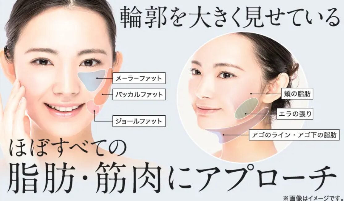 TAクリニックでは、輪郭を大きく見せているほぼすべての脂肪・筋肉にアプローチできます。