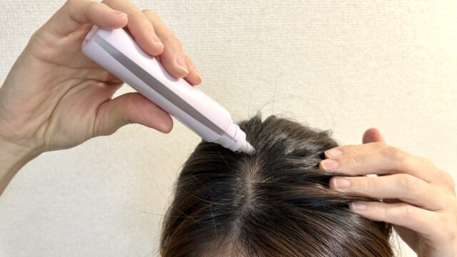 ドラッグストアなど市販の育毛剤を試したことがあります。