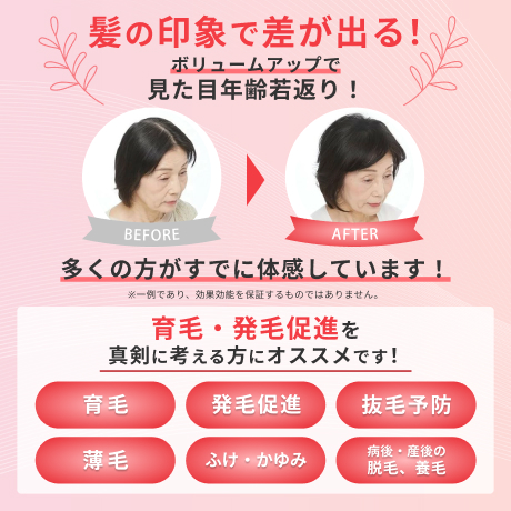 見た目年齢若返り！おすすめの育毛剤