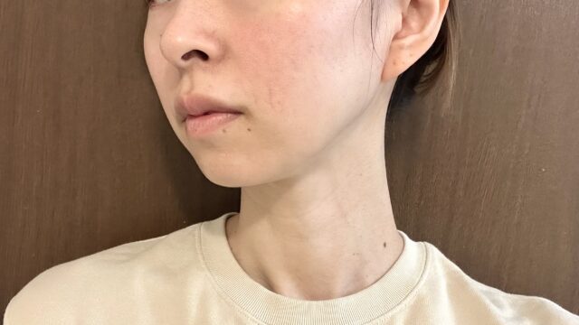 初回が安い＆クーポン利用でお得感がすごい！福岡でエラボトックスを受けるなら品川がおすすめ