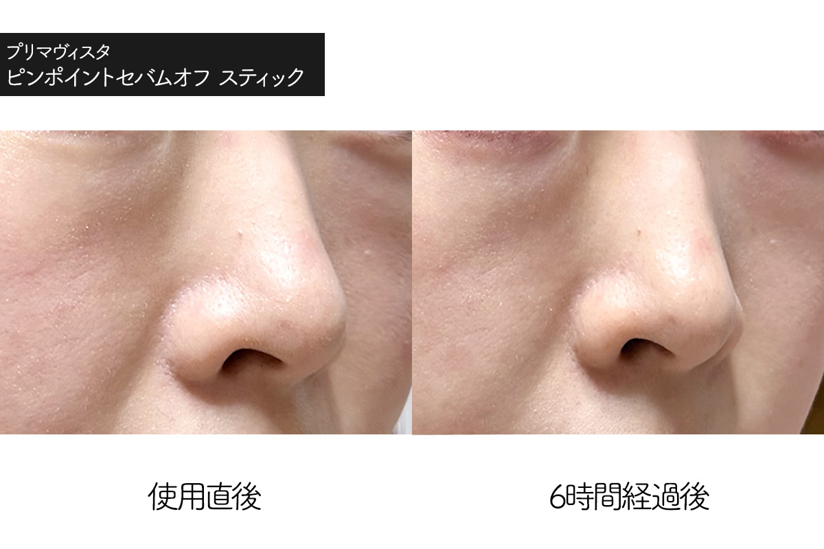 プリマヴィスタ テカリ防止スティック（ピンポイントセバムオフ スティック）の使用感レビュー　使用前　使用6時間後