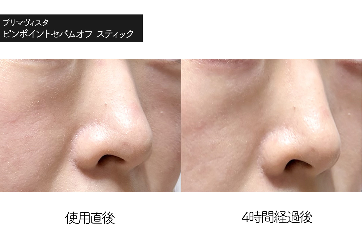 プリマヴィスタ テカリ防止スティック（ピンポイントセバムオフ スティック）の使用感レビュー　使用前　使用4時間後