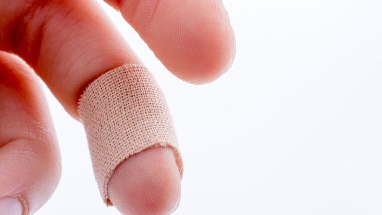 ジェルアレルギーのリアルな症状　皮膚の状態