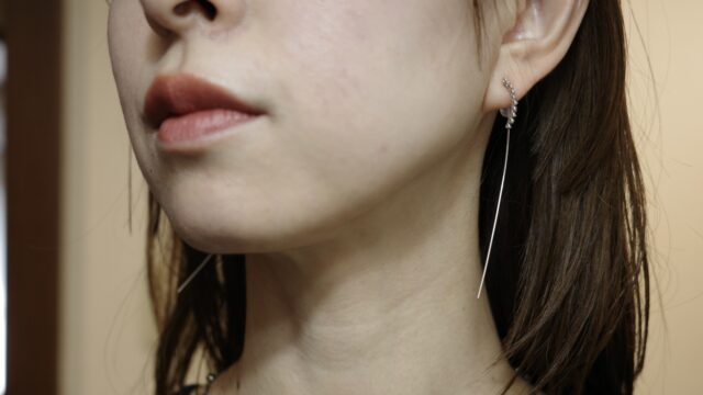 肌荒れ時にも使える、ドラッグストアで買える市販のおすすめスキンケア