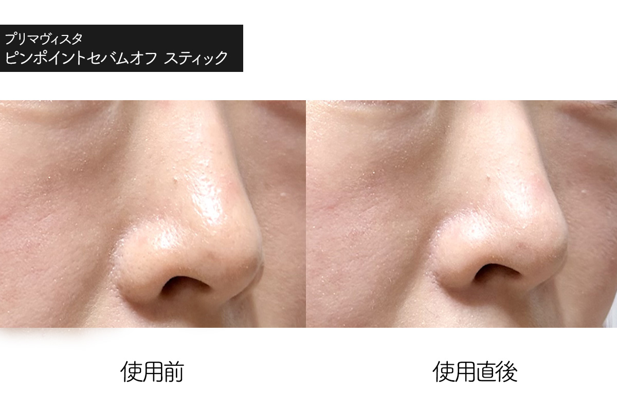 プリマヴィスタ テカリ防止スティック（ピンポイントセバムオフ スティック）の使用感レビュー　使用前　使用後