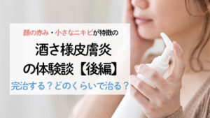 【酒さ様皮膚炎の体験談：後編】酒さは完治する？どのくらいで治る？