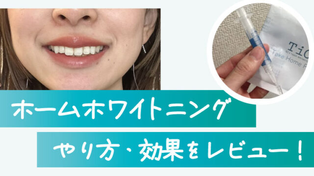 マウスピース上だけ、ジェル薬剤なら思ったより安かった！効果を実感するまでの期間、実際の白さも解説