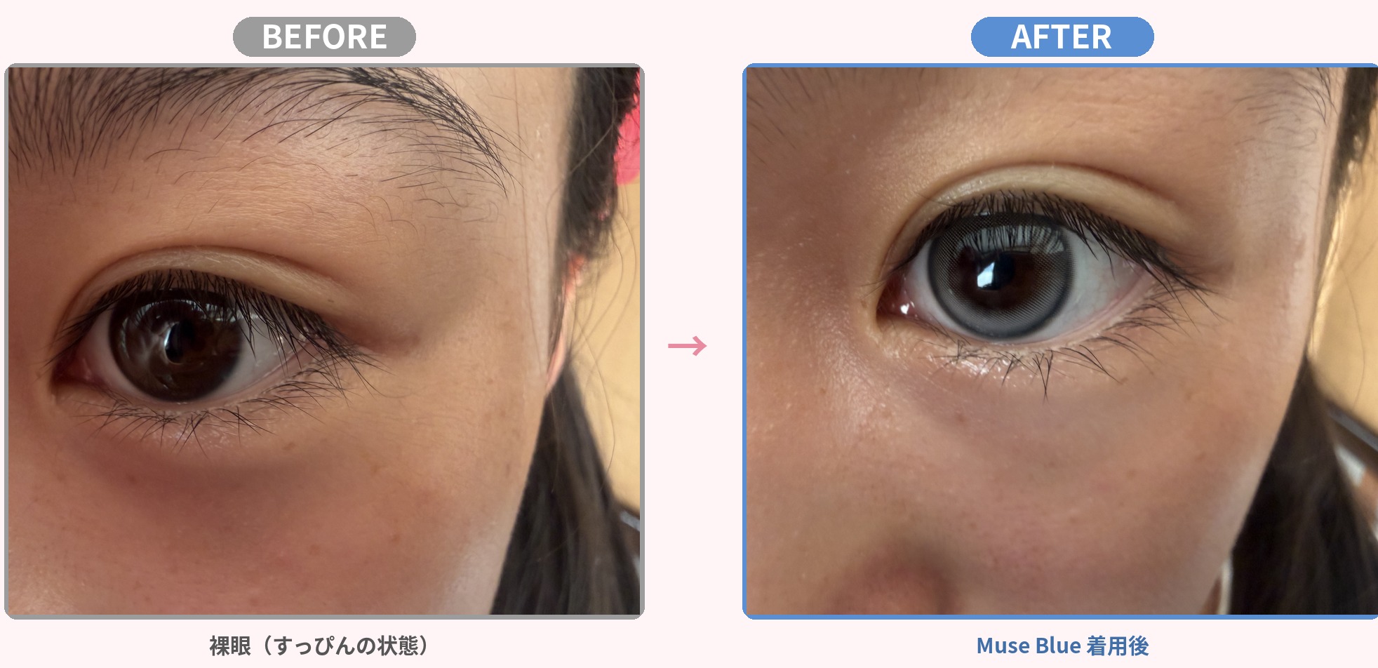 裸眼とMuse Blue着用のビフォーアフター比較